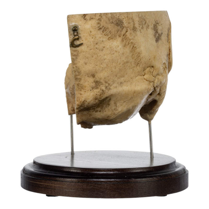 Real Human Partial Skull on Stand