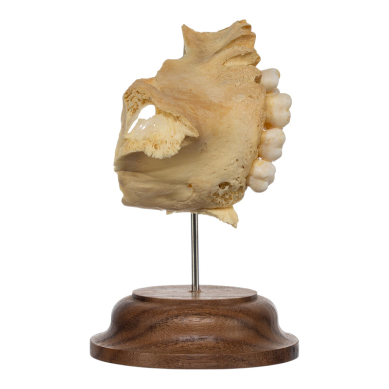 Real Human Partial Maxilla on Stand