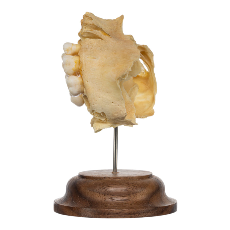 Real Human Partial Maxilla on Stand