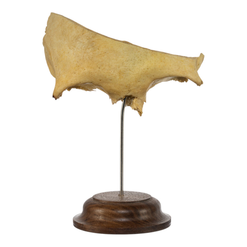 Real Human Partial Skull on Stand