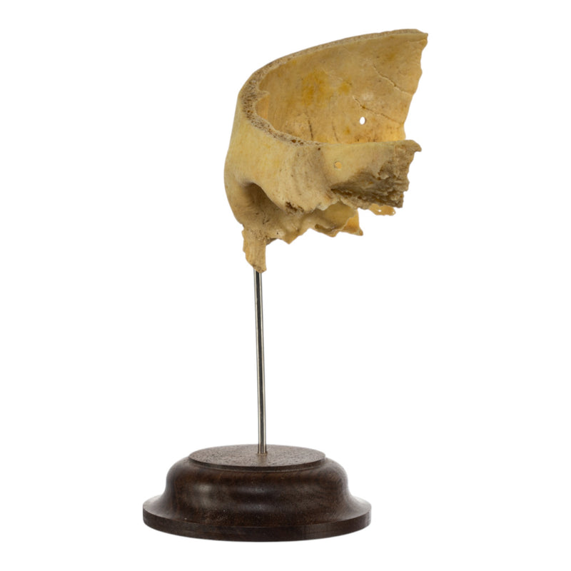 Real Human Partial Skull on Stand