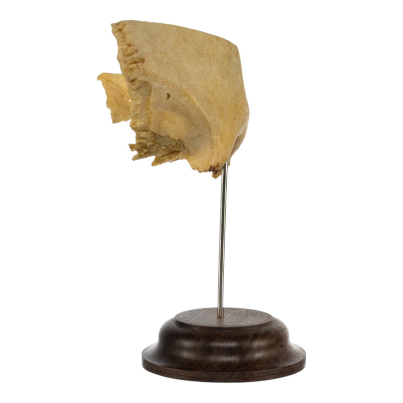 Real Human Partial Skull on Stand