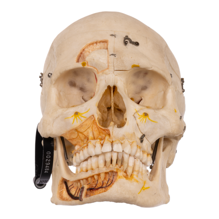 Real Human Skull with Carrying Case  - Dissected