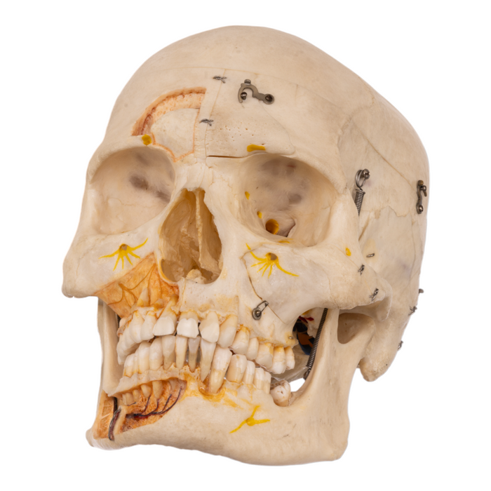 Real Human Skull with Carrying Case  - Dissected