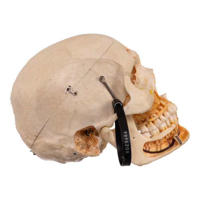 Real Human Skull with Carrying Case  - Dissected