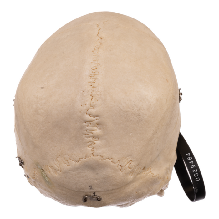 Real Human Skull with Carrying Case - Dissected