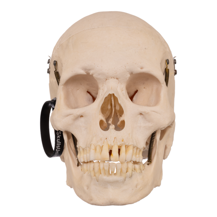 Real Human Skull with Carrying Case