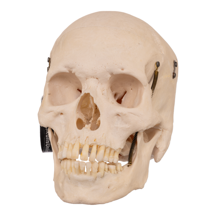 Real Human Skull with Carrying Case