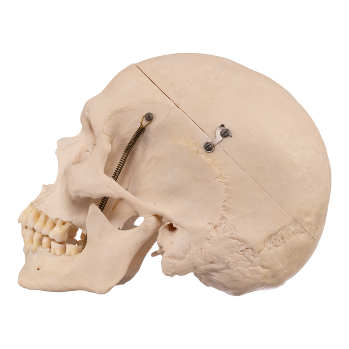 Real Human Skull with Carrying Case