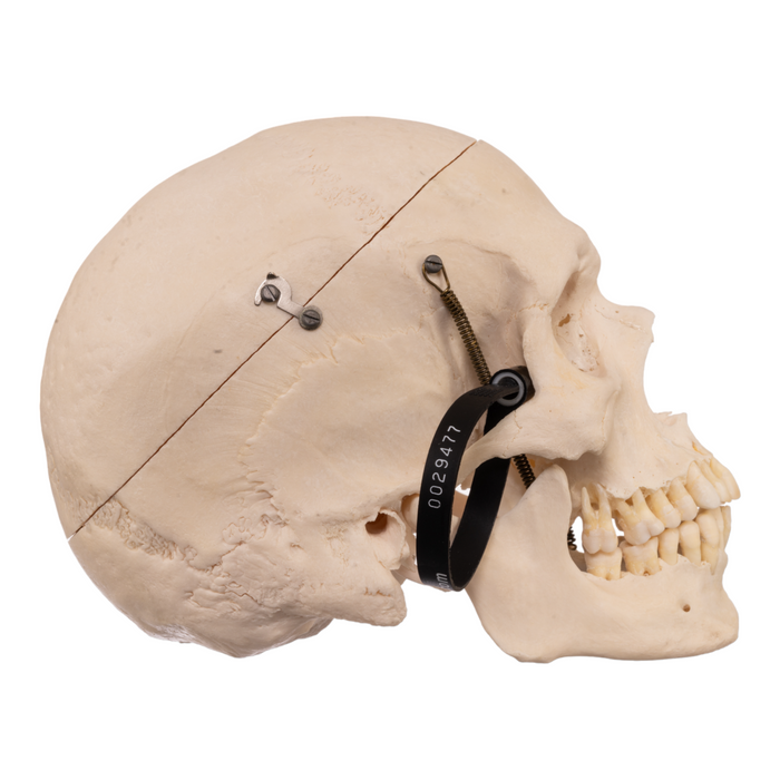 Real Human Skull with Carrying Case