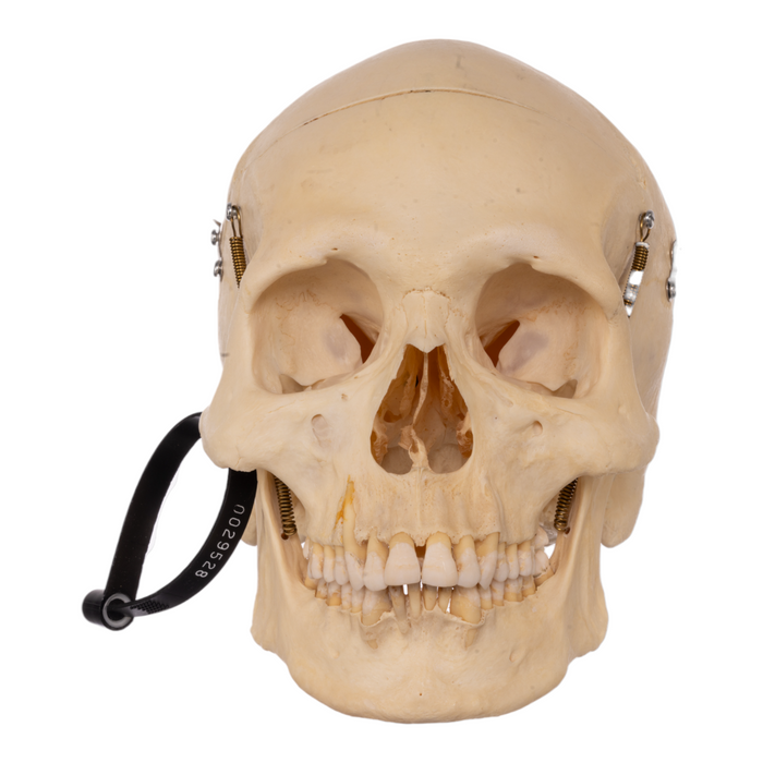 Real Human Half Skeleton with Carrying Case