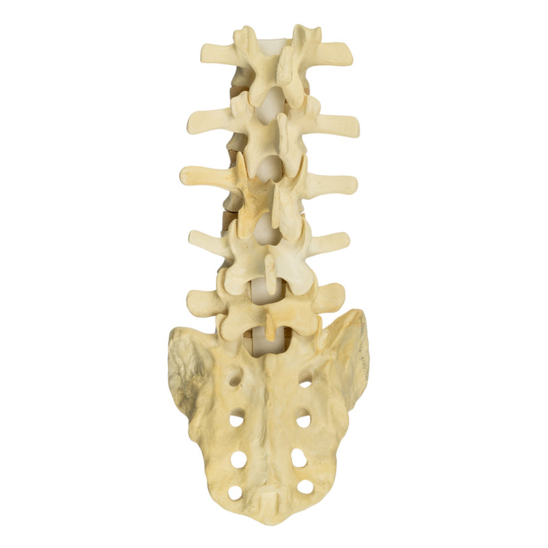 Replica Human Sacrum & Lumbar Model