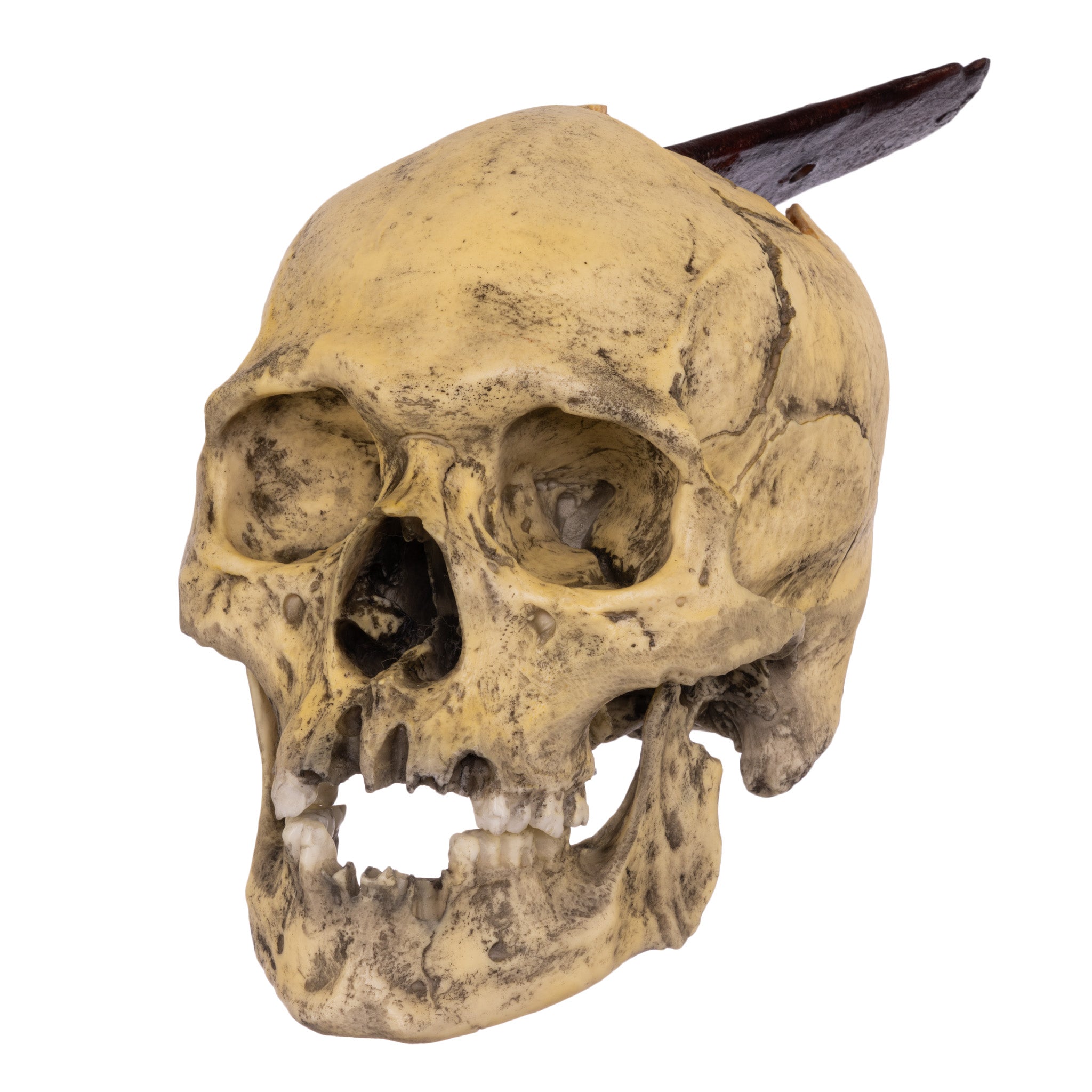 Replica Spanish Conquistador Human with Broad Ax Trauma Skull For