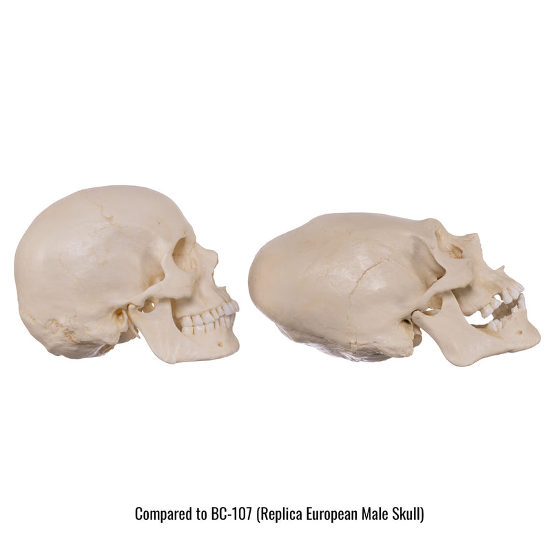 Replica Human Peruvian Male Skull with Cranial Binding & Trephination