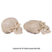 Replica Human Peruvian Male Skull with Cranial Binding & Trephination