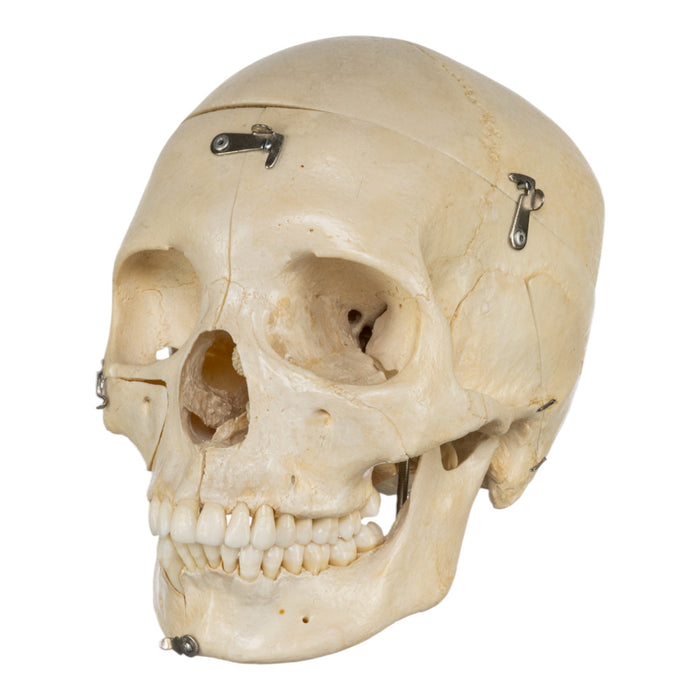 Real Human Skull - Dissected