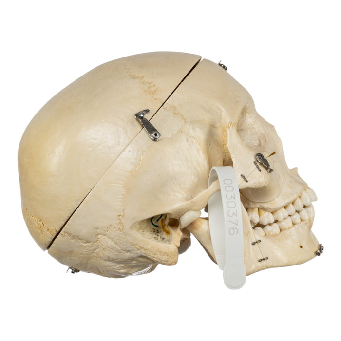 Real Human Skull - Dissected