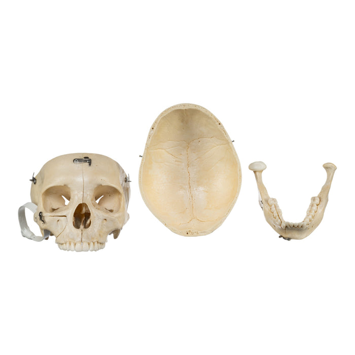 Real Human Skull - Dissected