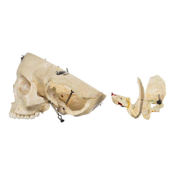 Real Human Skull - Dissected
