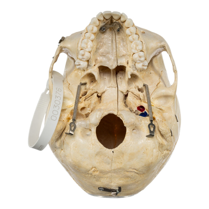 Real Human Skull - Dissected