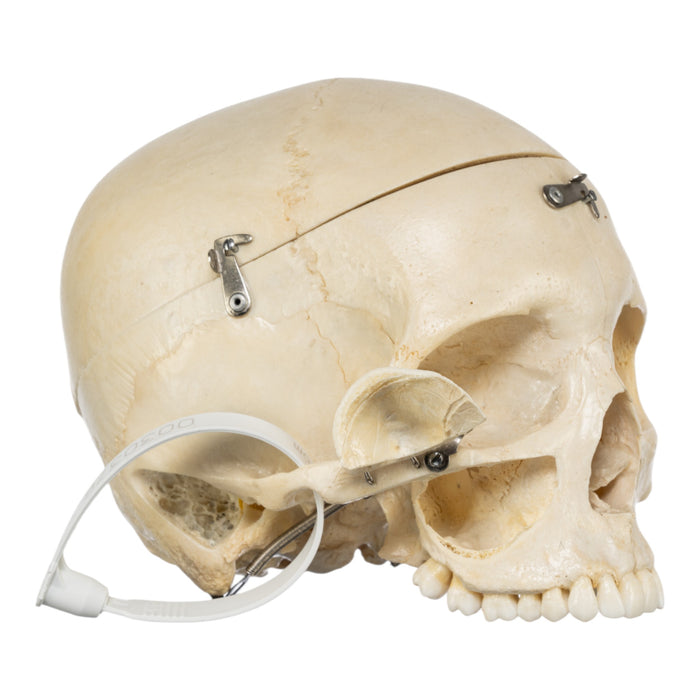 Real Human Skull - Dissected