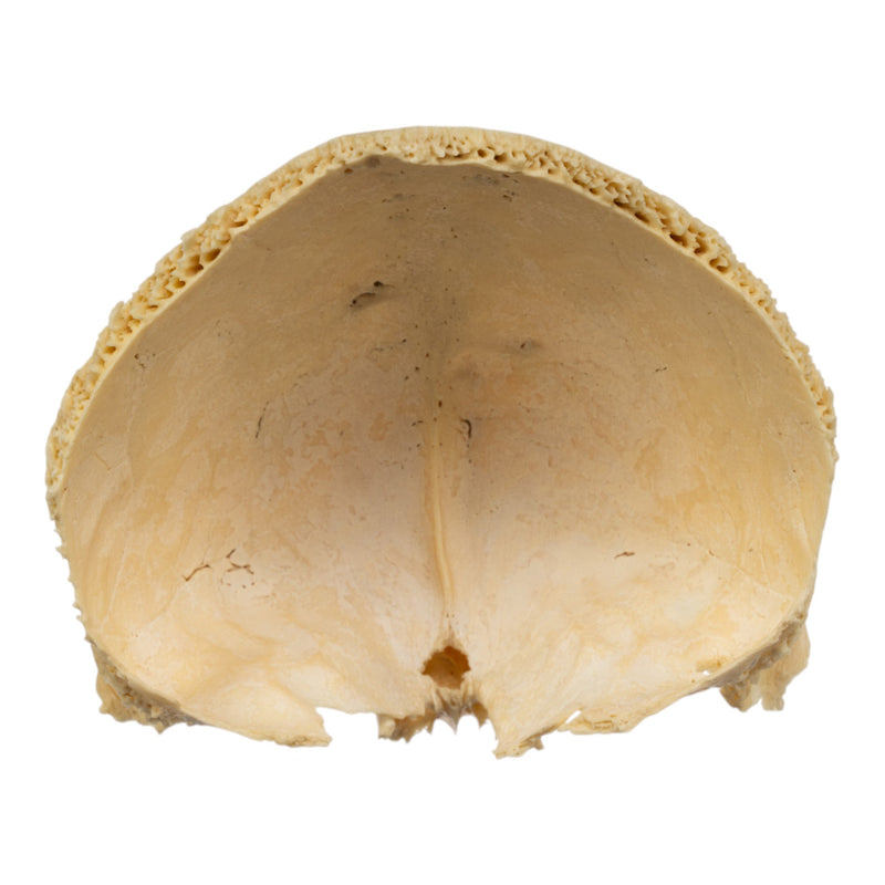 Real Human Frontal Bone