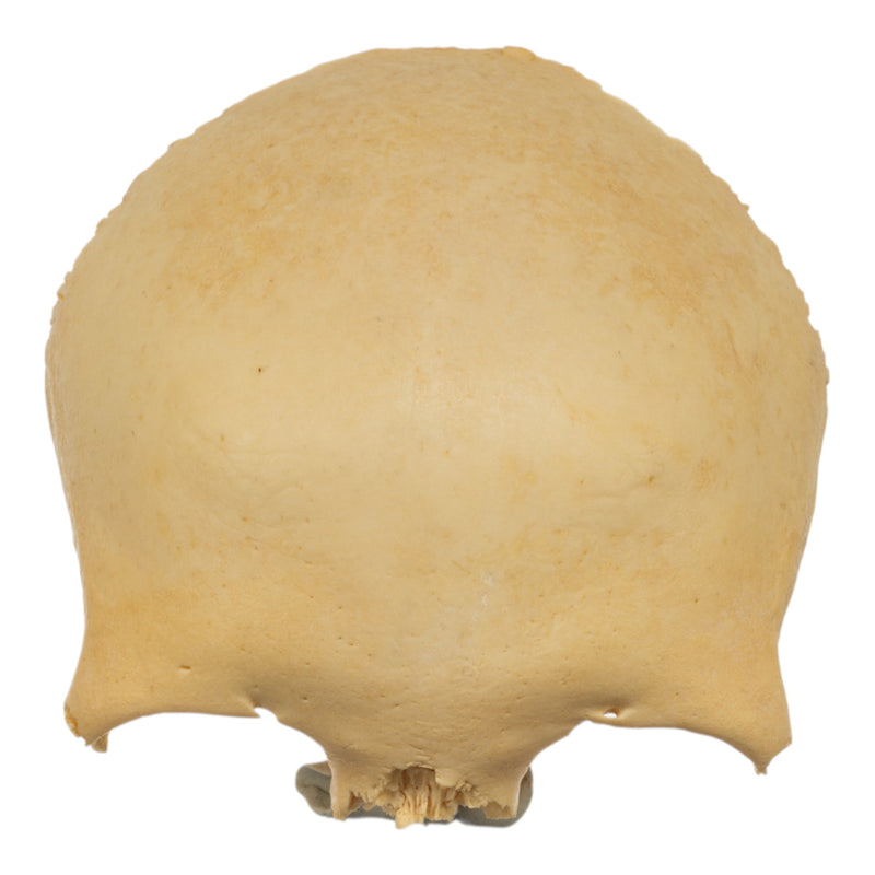 Real Human Frontal Bone