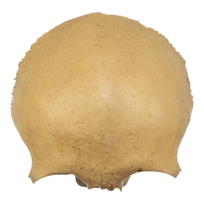 Real Human Frontal Bone