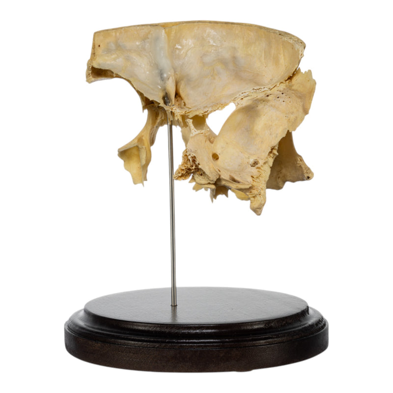 Real Human Partial Skull on Stand