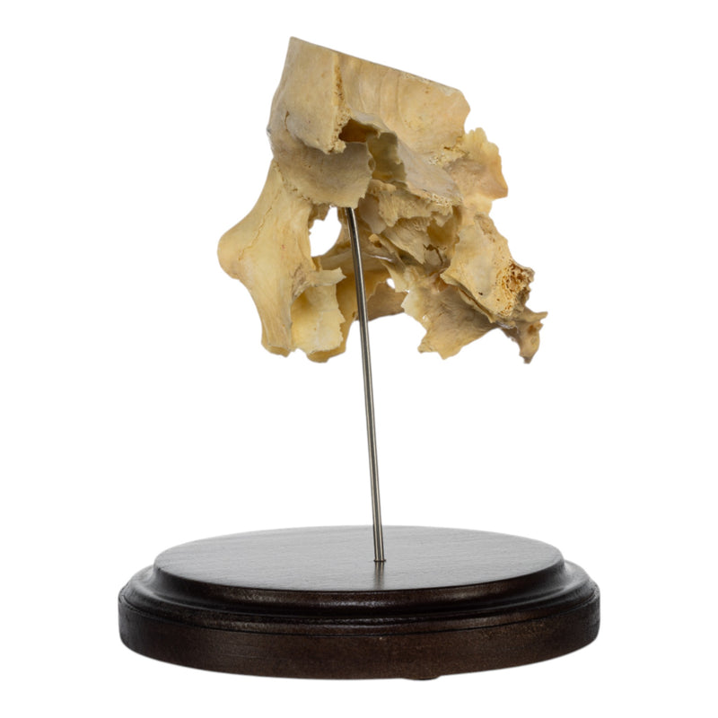 Real Human Partial Skull on Stand