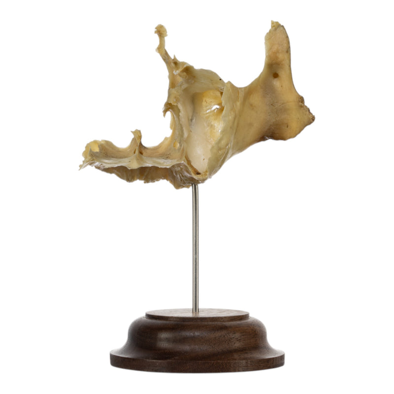 Real Human Partial Skull on Stand