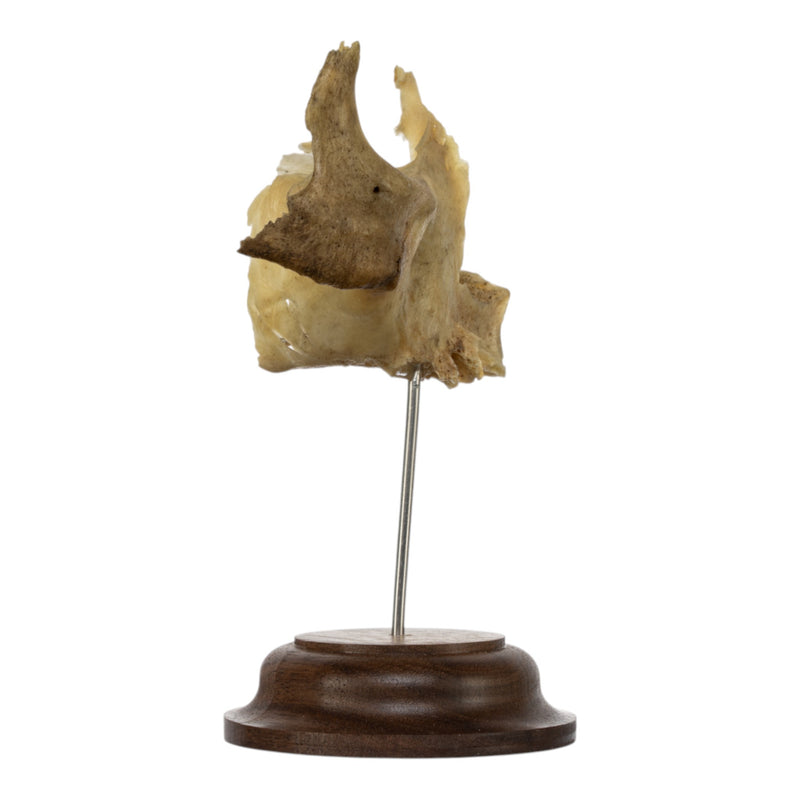 Real Human Partial Skull on Stand