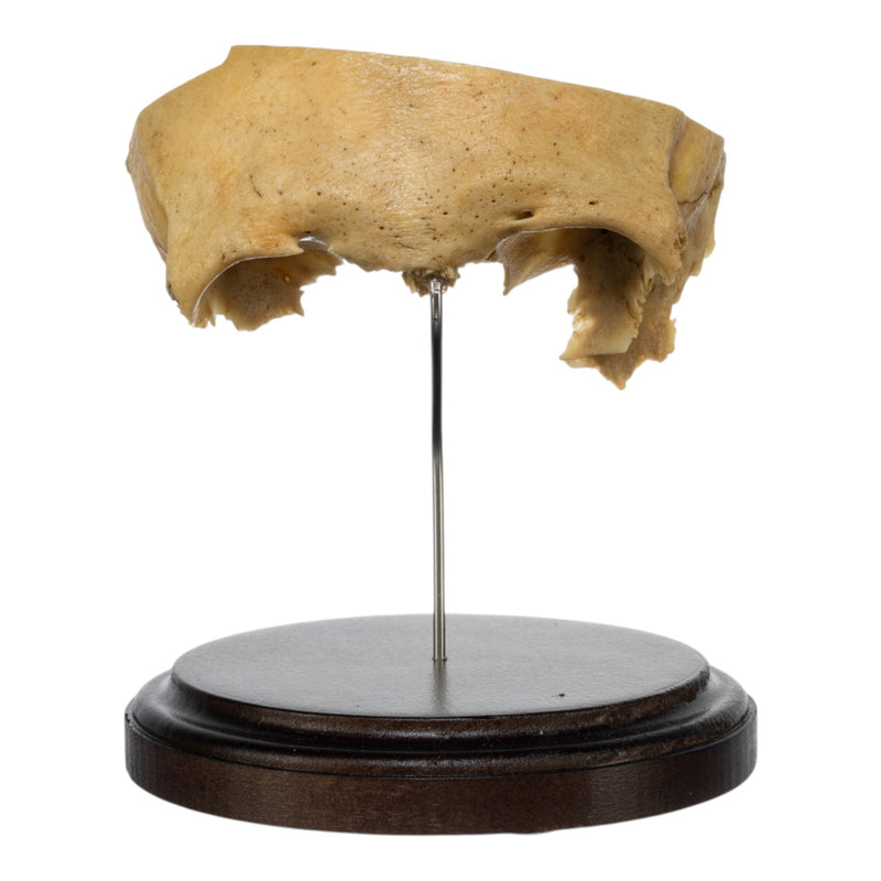 Real Human Partial Frontal Bone on Stand