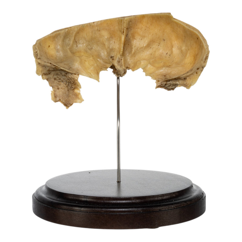 Real Human Partial Frontal Bone on Stand