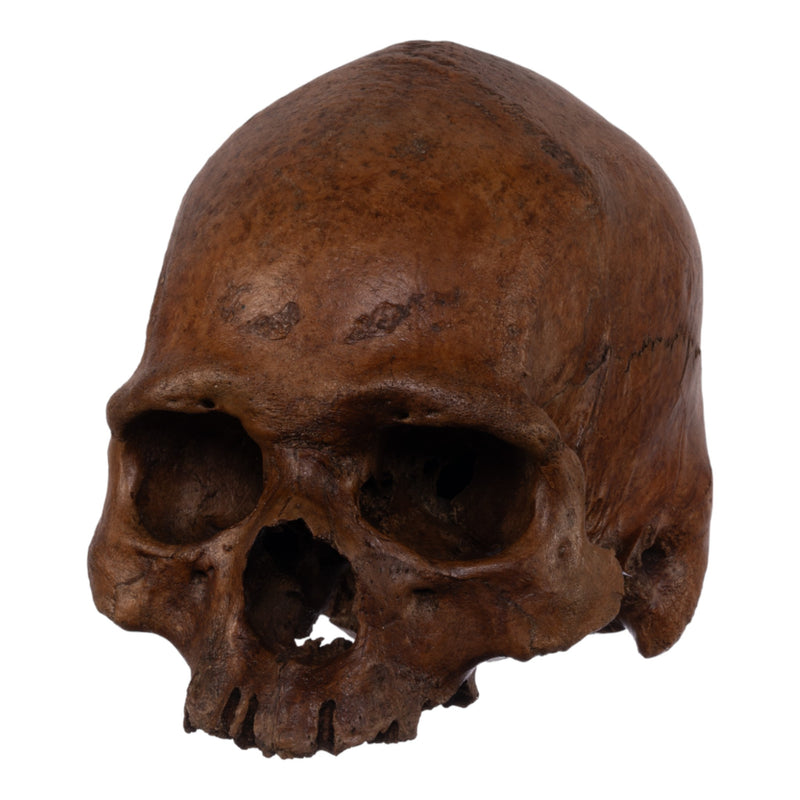 Real Human Skull without Mandible