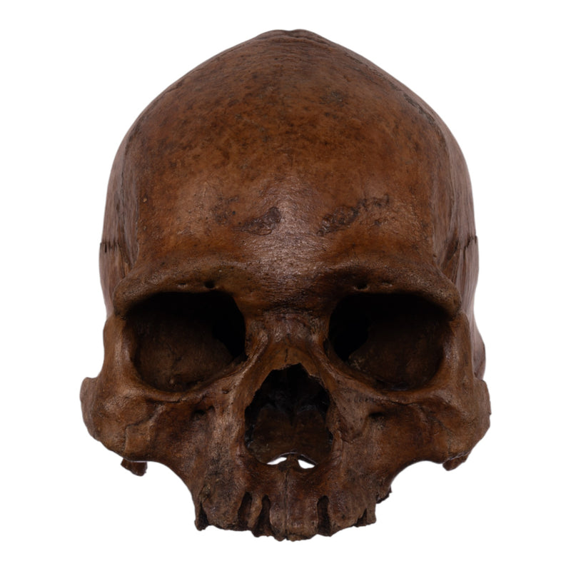 Real Human Skull without Mandible