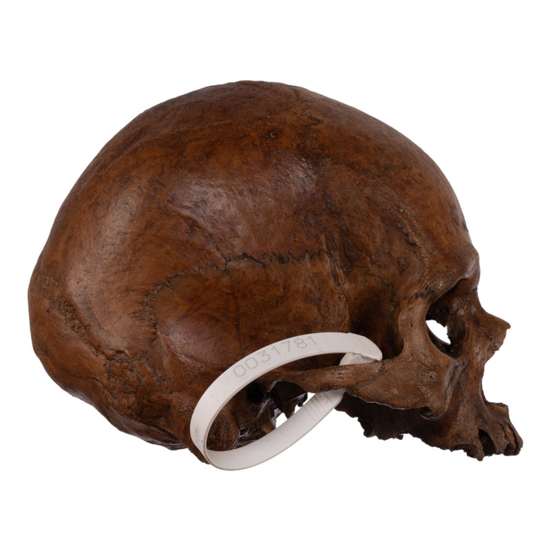 Real Human Skull without Mandible