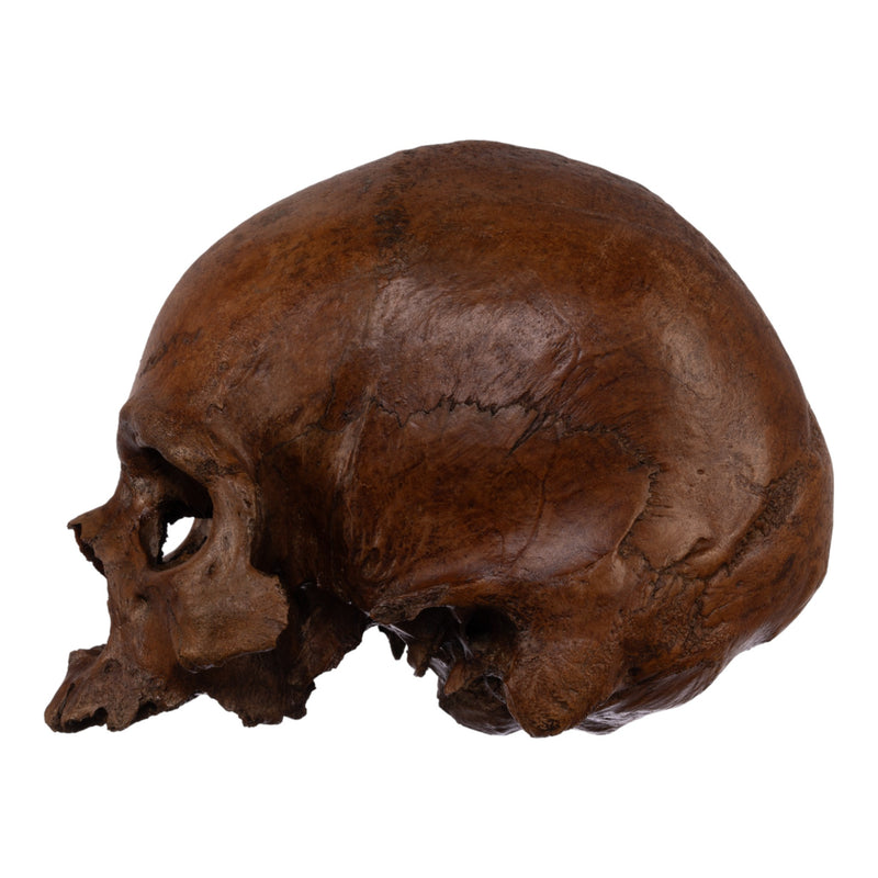 Real Human Skull without Mandible