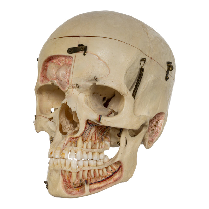 Real Human Dissected Skull in Carrying Case