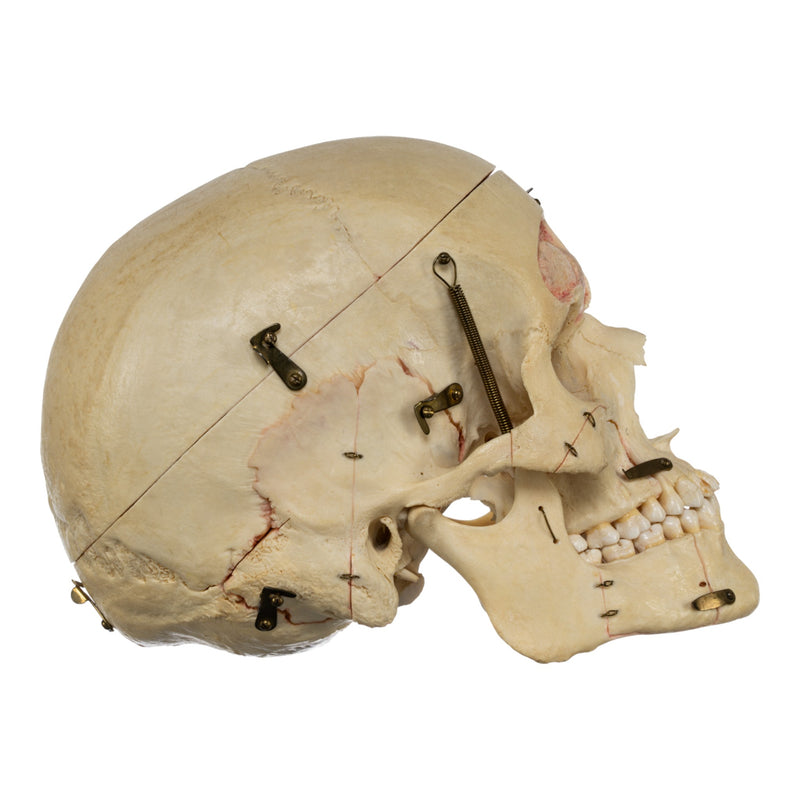 Real Human Dissected Skull in Carrying Case