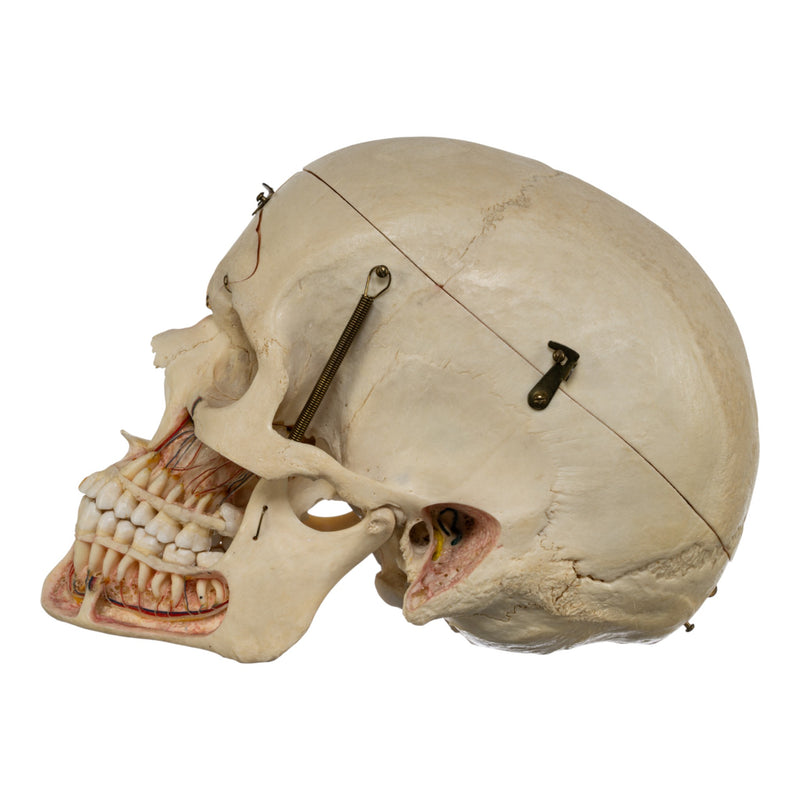 Real Human Dissected Skull in Carrying Case