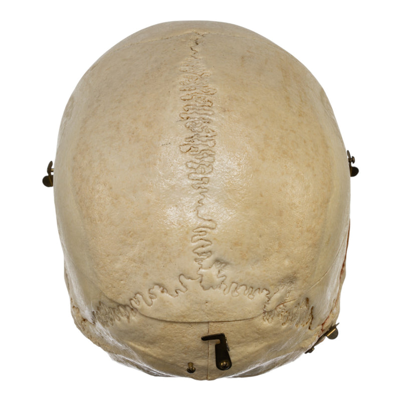 Real Human Dissected Skull in Carrying Case