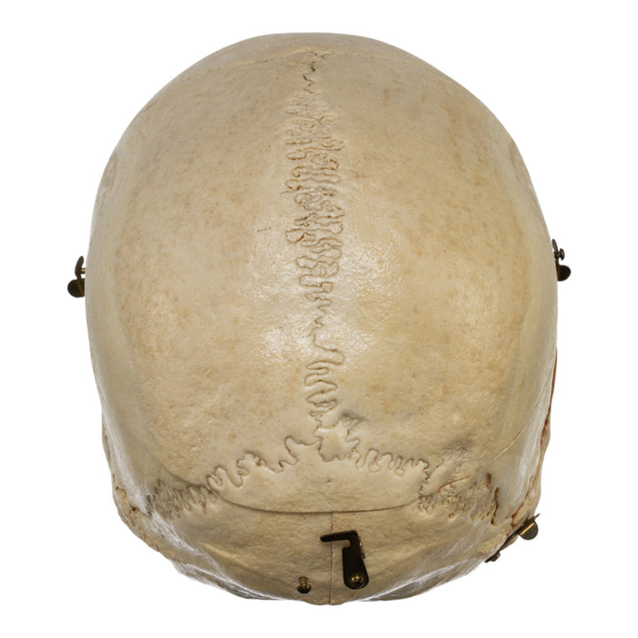 Real Human Dissected Skull in Carrying Case