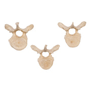 Real Human Thoracic Vertebra - Single