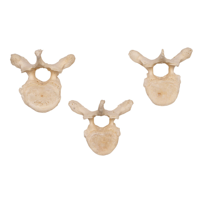 Real Human Thoracic Vertebra - Single