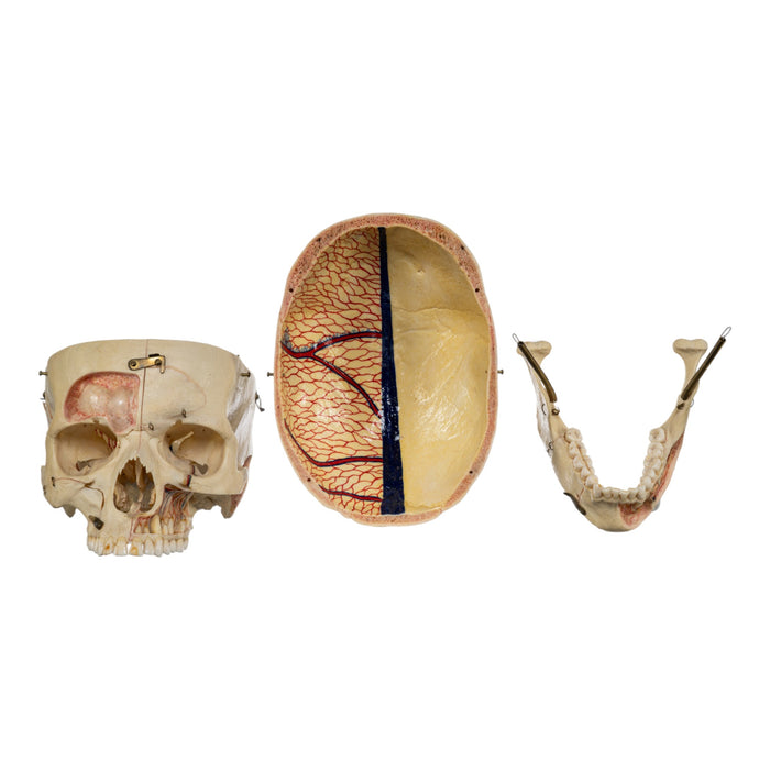 Real Human Dissected Skull in Carrying Case