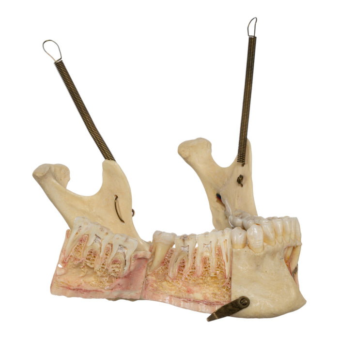 Real Human Dissected Skull in Carrying Case