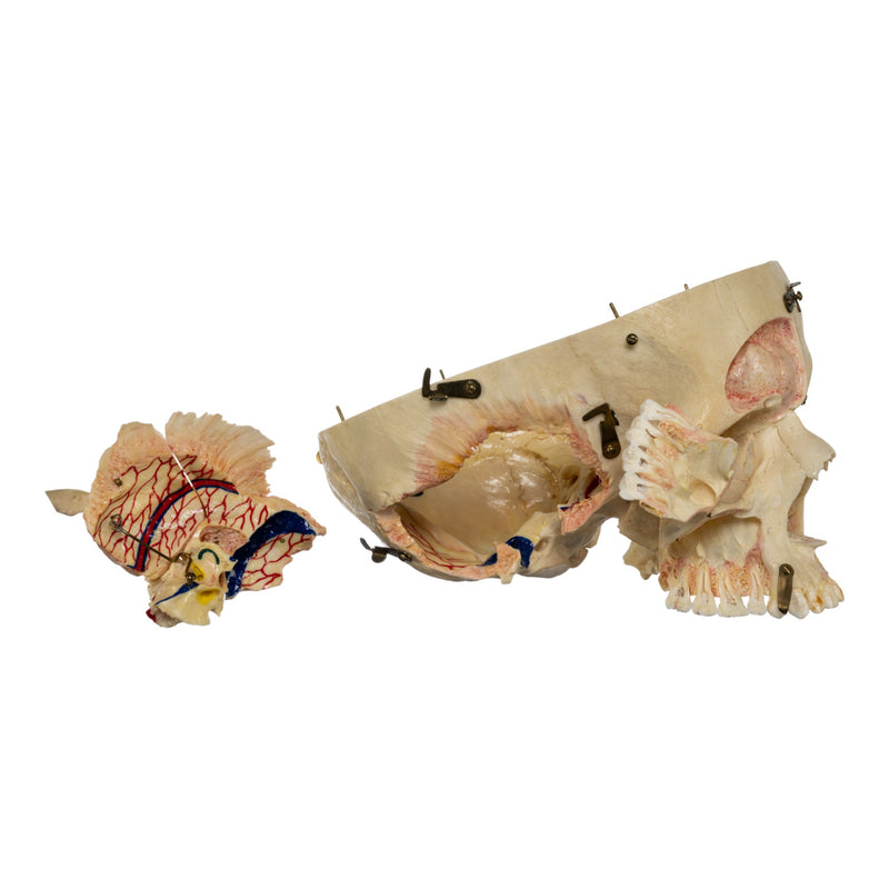 Real Human Dissected Skull in Carrying Case