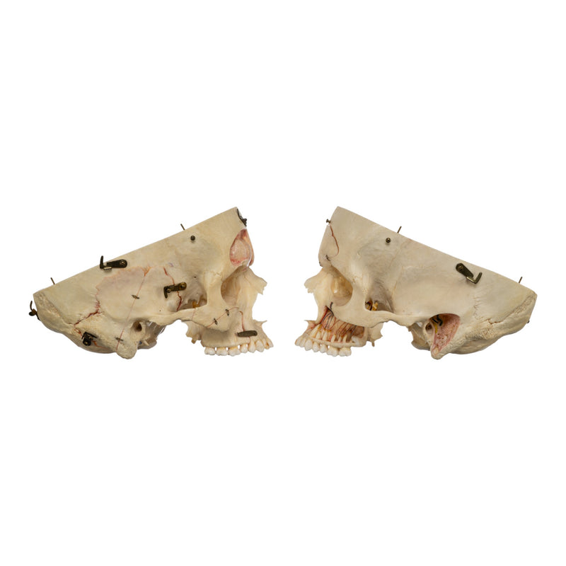 Real Human Dissected Skull in Carrying Case