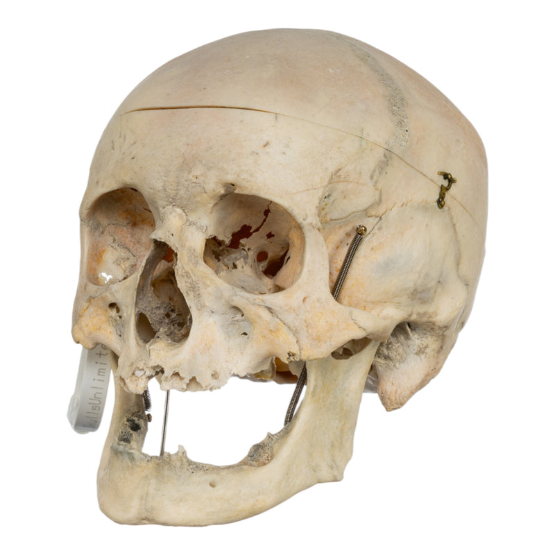 Real Human Skull